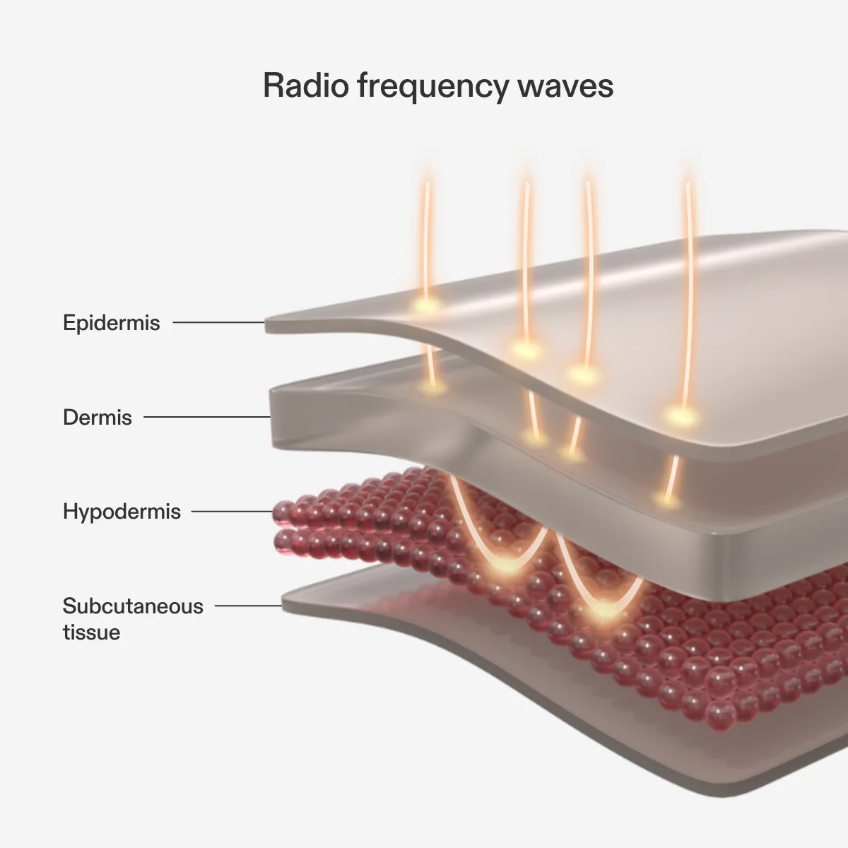 Currentbody - Skin RF Radio Frequency Skin Tightening Device - Image 4