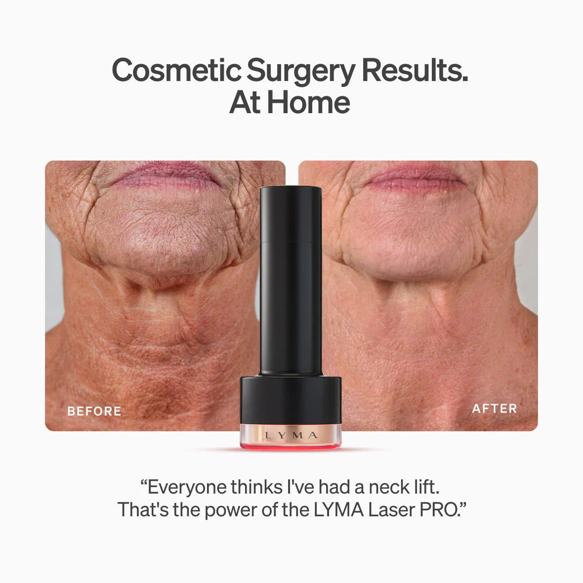 Lyma - LYMA Laser PRO - Image 14