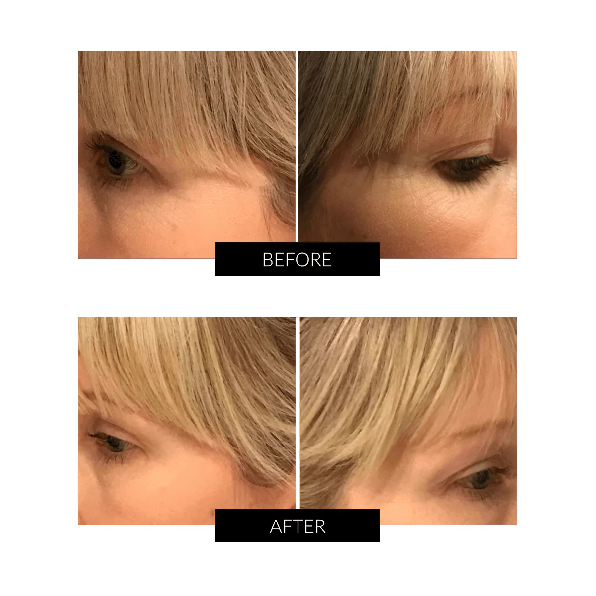 Currentbody - OXYjet GO Oxygen Facial System - Image 3
