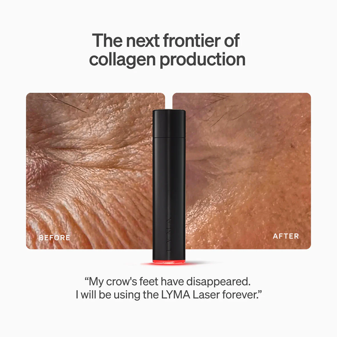 Lyma - The LYMA Laser - Image 11
